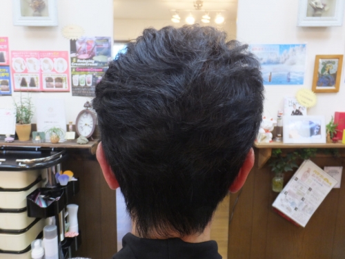 マレーアレナータカール施術で小顔効果!!