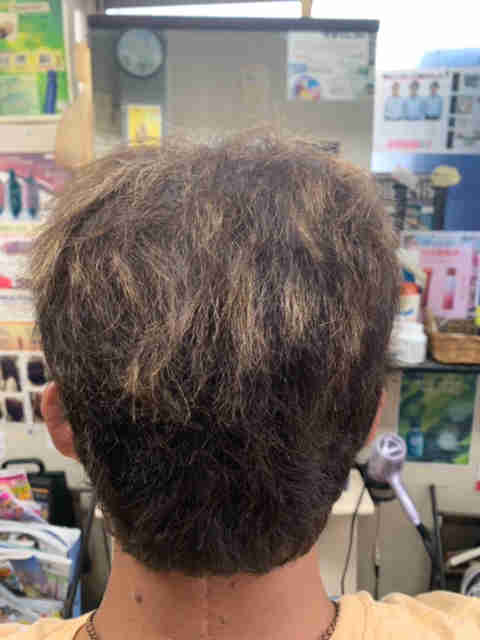 マレーア・レナータ縮毛矯正：ビフォー